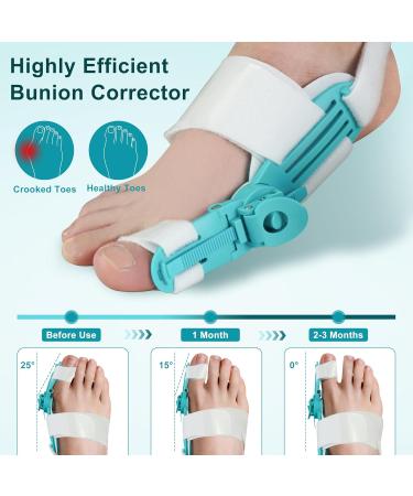 Buy Bunion Corrector for Women & Men | Adjustable Orthopedic Big Toe Support | Left & Right Feet | Green (1PC - Buy Online on GoSupps.com