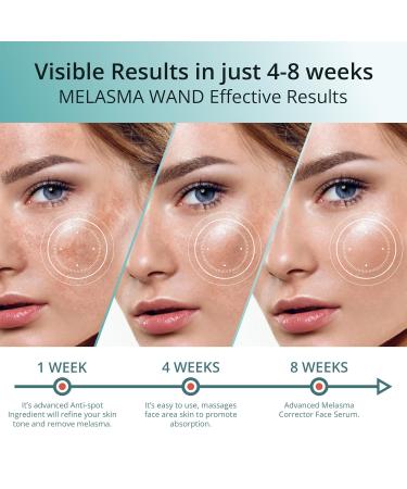 Abera Melasma Serum with Niacinamide & Hyaluronic Acid | Dark Spot Corrector | Melasma Treatment for All Skin Types - Set of 3 (0.68 fl. Oz - Buy Online on GoSupps.com