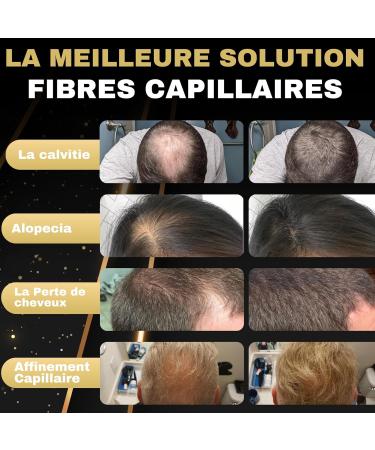 Salvathor Duran Hair Densifying Powder 25g - Hair Powder - Hair Fiber 25g - Hair Densifying Powder - Anti Baldness Powder - Buy Online on GoSupps.com