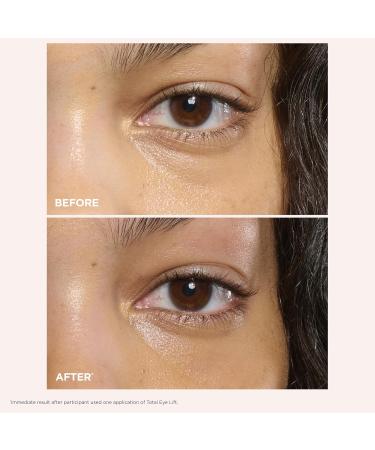 Clarins NEW Total Eye Lift | Anti Aging Eye Cream | Targets Wrinkles Crow's Feet Dark Circles and Puffiness For a Visible Eye Lift in 30 Seconds | REFILLABLE Total Eye Lift 0.5 Oz - Buy Online on GoSupps.com