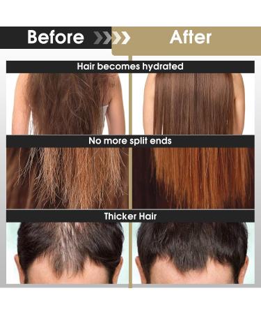 Batana Oil for Hair Growth - Natural Conditioner & Thickening Oil for Men & Women - Repairs Damage Eliminates Frizz 4.23oz - Buy Online on GoSupps.com