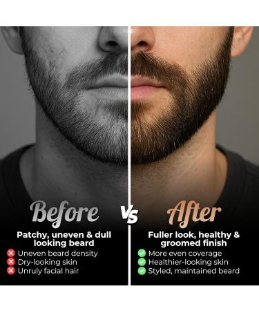 Kit de croissance barbe et cheveux Dermaroller 0 5 mm + s rum de croissance V gan et non test sur les animaux - Buy Online on GoSupps.com