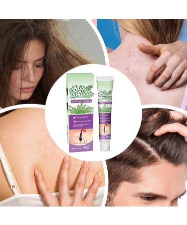  WJnflQN Scalp Relief | 20g Non-Greasy Ointment | Nourishing Scalp Gel For Women and Men Home Salon Travel Shower Seasonal Comfort - Buy Online on GoSupps.com