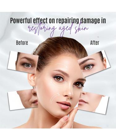 30% Matrixyl 3000 Face Cream - Anti-Aging Skin Elasticity Repair with Peptides Vitamins C & E Hyaluronic Acid & Aloe Vera - Firming & Lifting Solution (1.7 fl oz - Buy Online on GoSupps.com