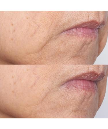 Perricone MD Cold Plasma Plus+ Intensive Gel Mask - 2 fl. oz. | Premium Anti-Aging Skincare | Free International Shipping - Buy Online on GoSupps.com