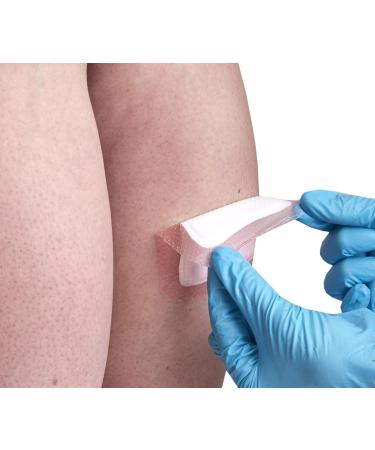 Buy Smith+Nephew ALLEVYN GENTLE BORDER Foam Dressing 3in X 3in - Fast International Shipping & Superior Wound Care - Buy Online on GoSupps.com