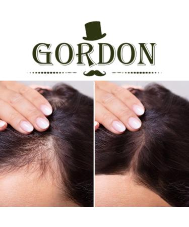 Gordon Fibres capillaires Fibres paississantes (22 g) + recharge de 25 g dans un sachet refermable couverture instantan e pour cheveux clairsem s (ch taignier fonc marron fonc ) - Buy Online on GoSupps.com