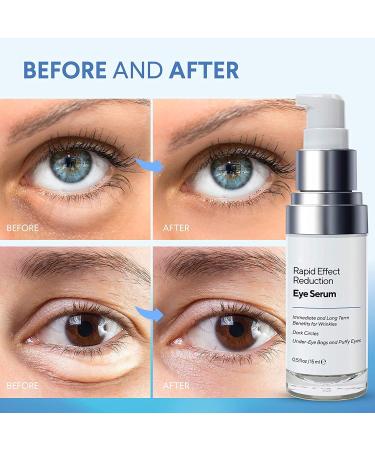 LANMERI E-Lift Under Eye Cream - Instant Eye Lift for Fine Lines & Wrinkles - Buy Online on GoSupps.com