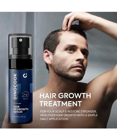 Men's Extra Strength 5% Minoxidil Hair Regrowth Treatment Spray with DHT Blocker - Hair Growth Serum with Vitamins for Thinning Hair - Minoxidil 5% Formula - Buy Online on GoSupps.com