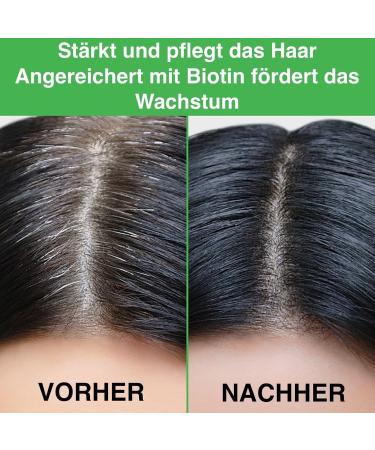 P-Beauty Rosemary Conditioner - 1x300ml for damaged and dry hair | Conditioner for hair growth and scalp care | Rosemary Mint | Hair care - Buy Online on GoSupps.com