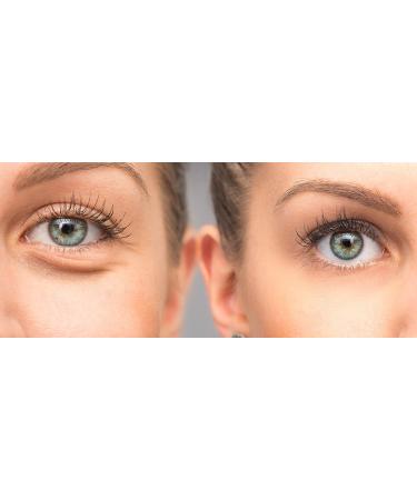 Organic Youth Renewal Eye Cream - USDA Certified Organic - 1 oz - Restores Firmness & Elasticity - Intensive Hydration for Mature & Sensitive Skin - Buy Online on GoSupps.com