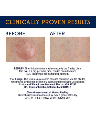 Theriac Manuka Honey Healing Ointment - Natural 50% Faster Healing for Cuts, Scrapes, Burns (0.5 Oz) - Buy Online on GoSupps.com