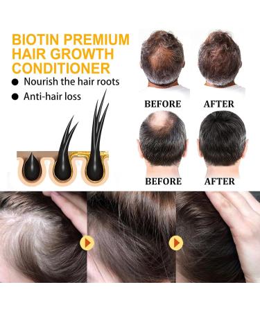 Nmbol Hair Mask Biotin Conditioner for Hair Thickness Biotin Premium Hair Growth Conditioner Biotin & Collagen Conditioner Hair Cream for Hair Growth Collagen Wheat Proteins 120ml - Buy Online on GoSupps.com