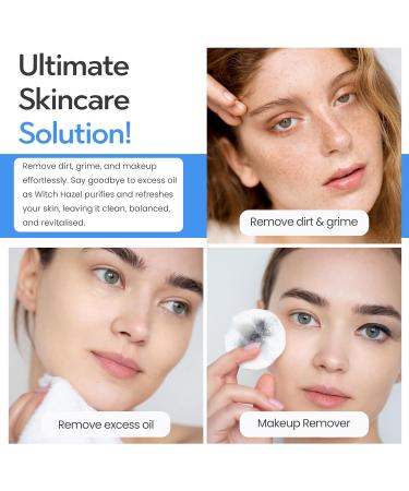 Freshskin Beauty LTD | Witch Hazel Distillate BPC/USP 500ml - Natural Distilled Skin Toner 500 ml (Pack of 1) - Buy Online on GoSupps.com