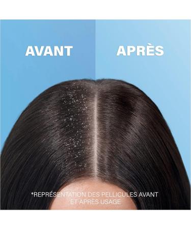 Head & Shoulders Classic Anti-Dandruff Shampoo Cleanses and Moisturizes Hair and Scalp Pack of 6x285ml - Buy Online on GoSupps.com