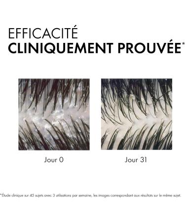 Vichy Dercos Anti-dandruff shampoo Advanced action Normal to oily hair 390 ml - Buy Online on GoSupps.com