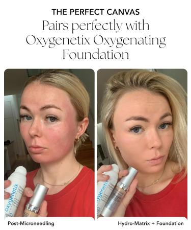 Oxygenetix Oxygenating Hydro-Matrix (2.54oz) | Lightweight Aloe-Based Face Moisturizer with Hyaluronic Acid for Sensitive Dry or Compromised Skin - Buy Online on GoSupps.com