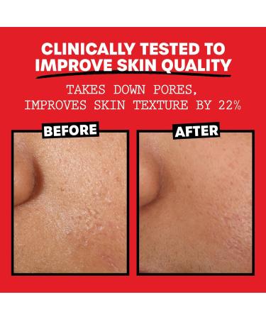 Thayers Alcohol-Free Rose Petal Witch Hazel Facial Toner Soothing and Hydrating for All Skin Types Including Sensitive Alcohol Free VALUE Duo Pack (2 x 355mL) - Buy Online on GoSupps.com