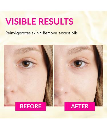 Wake Skincare Reinvigorating Daily Toner with Witch Hazel and Allantoin -Toner for Face - Toner for Oily Skin - Hydrating Toner - 200ml - Buy Online on GoSupps.com