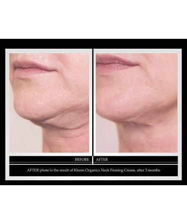 Peptide & Retinol Neck Firming Cream | Anti-Aging & Skin Tightening | Reduce Wrinkles, Age Spots, & Sagging Skin | Natural & Youthful | 1.7 oz - Buy Online on GoSupps.com