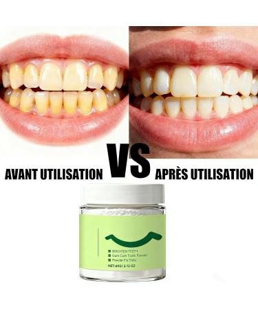 Poudre Dentaire Au Collag ne 60 g Poudre De Renforcement Du Sourire Collagum Collagum Smile Strengthening Collagen Powder Dents En Collag ne Poudre De Soin Pour Dentifrice Prot ge Les Gencives (2PC) - Buy Online on GoSupps.com