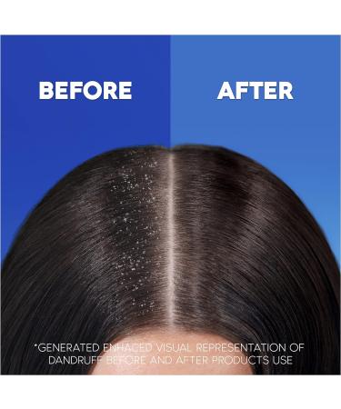 Head & Shoulders Classic Clean 2in1 Anti Dandruff Shampoo 1000ml. Up to 100% Flake Free Clinically Proven. For Any Hair and Scalp Type. For Daily use. Clean Feeling (Pack of 2) 1 l (Pack of 2) - Buy Online on GoSupps.com