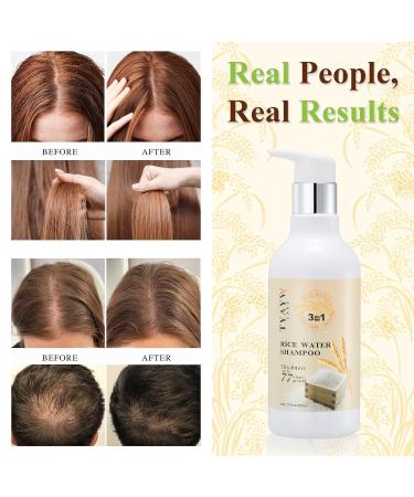 Rice Water Shampoo for Hair Growth & Thinning - Biotin & Rosemary Infused | Thickening Formula for Men & Women | Organic & Color Safe - Buy Online on GoSupps.com