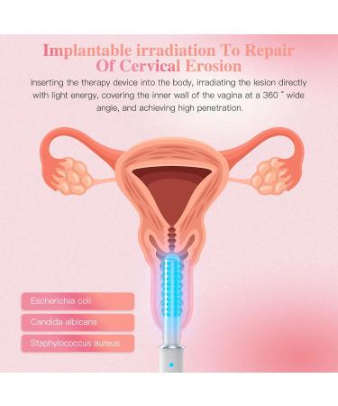 Vaginal Rejuvenation Wand | Red & Blue Light Gynecological Therapy Device for Women | Enhance Vaginal Health & PH Balance - Buy Online on GoSupps.com