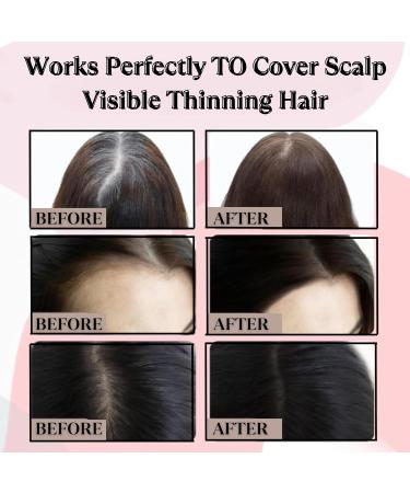 PRMGLOBAL Voulumon Root Touch Up Powder - Hairline Shadow Powder - Instantly Cover Grays -Sweatproof with Brush- Hair Root Cover UP Powder for Loss Thin Hair Bald Spots for Women & Men (Dark Brown) - Buy Online on GoSupps.com