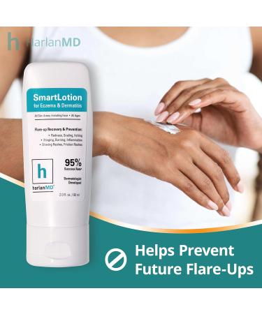 Buy SmartLotion Cream for Dermatitis & Eczema Treatment | Prebiotic Formula 2 Fl Oz - Fast International Shipping - Buy Online on GoSupps.com