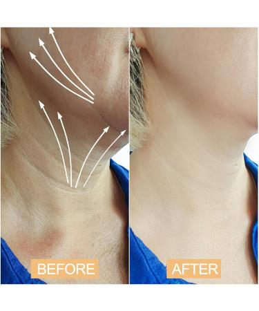 Neck Lift Tape Tightening Tape - Neck Tape Lifting Invisible - Buy Online on GoSupps.com