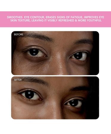 Buy FOREO IRIS 2 Eye Massager - Dark Circle & Eye Bag Remover | Enhanced Absorption & Anti-Wrinkle | 2-Year Warranty - Pearl Pink - Buy Online on GoSupps.com