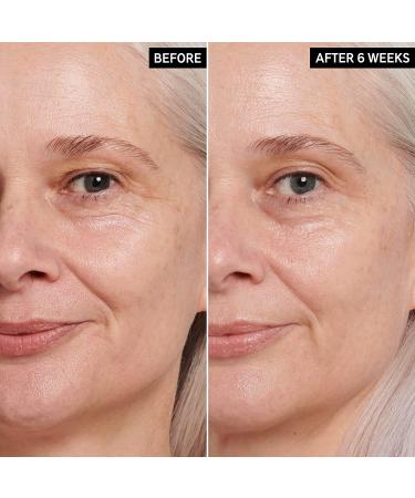 INKEY List Retinol Eye Cream 0.5 fl oz - Reduce Wrinkles, Fine Lines & Boost Collagen - Buy Online on GoSupps.com