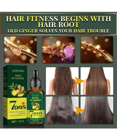 VigCebit 30ml Hair Growth Essence - Ginger Oil for Quick Dense Hair Growth & Nourishment | Anti-Hair Loss Solution - Buy Online on GoSupps.com
