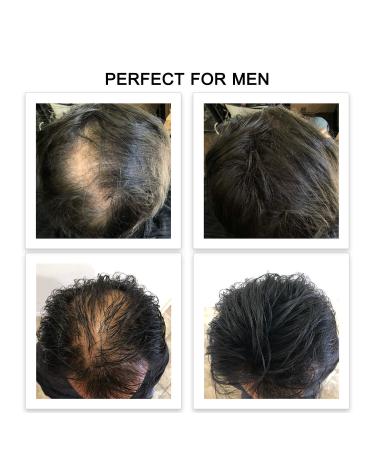 FEBRON Hair Fibers 30G MEDIUM BROWN - Hair Loss Concealer for Women & Men - 100% Natural Volumizing Powder - Bold Spots Filler - 1.06 oz - Buy Online on GoSupps.com