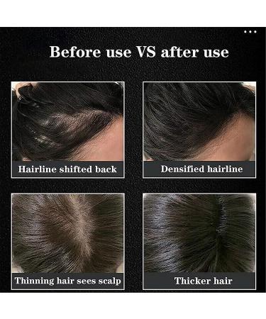 Regrow Hair Growth Oil | Anti Hair Loss Serum & Herbal Scalp Massager - Intense Hair Growth for All Hair Types - Buy Online on GoSupps.com