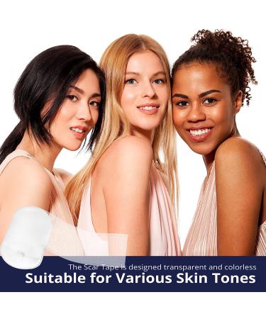 Silicone Scar Sheets - Treating Keloid, C-Section, Tummy Tuck - Surgical Gel Patch Bandage - Transparent Reusable Breathable - Buy Online on GoSupps.com