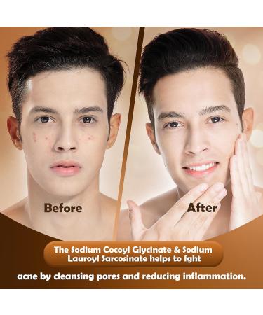 Foaming Facial Cleanser for Oily Skin | Hyaluronic Acid & Niacinamide Face Wash | Fragrance-Free Daily Mousse | 5.07 FL. OZ - Buy Online on GoSupps.com