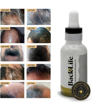 Back2Life 100% Natural Hair Stimulation & Beard Growth Oil - Say Goodbye to Patchy Beards - Moisturizing Serum for Hair & Beard - Scalp Repair & Regrowth Formula - Buy Online on GoSupps.com