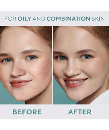 OhMy Clear Face Foundation - Acne Coverage with SPF-Enhanced Salicylic Acid & Tea Tree Extract - Dewy Finish for Sensitive Skin - Organic & Oil-Free - Soft Beige - 1.35 fl.oz - Buy Online on GoSupps.com