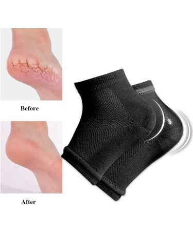 Aokbean Heel Socks - 2 Pairs Moisturizing Gel Socks for Dry Cracked Skin | Open Tip Silicone Foot Care for Men & Women (Black + Gray) - Buy Online on GoSupps.com