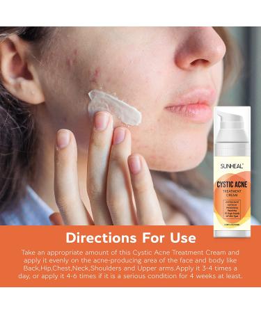 Cystic Hormonal and Severe Acne Treatment Cream - Anti Acne Ingredients, USA Designed, Japan Formulated (100ml/3.38oz) - Buy Online on GoSupps.com