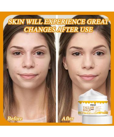 Beef Tallow Balm 3 Bottles Beef Tallow Cream Beef Tallow Skin Care Beef Tallow Cream for Skin Care Whipped Face and Body Moisturizer for All Skin Types - Buy Online on GoSupps.com