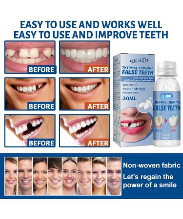 Meharey Tooth Repair Shaping Teether Kit | Temporary Tooth Restoration Granules & Beads | Dental Repair Set (1PC) for Effective Tooth Repair - Buy Online on GoSupps.com
