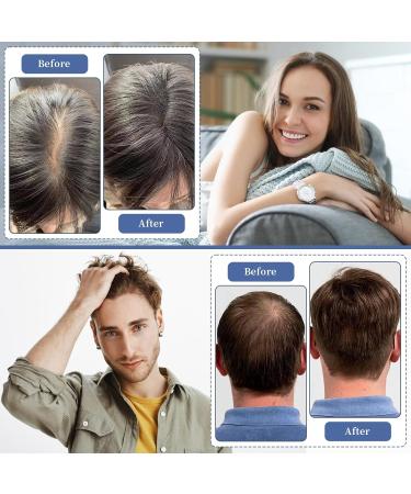 Laser Hair Growth Comb Red Light Therapy for Hair Growth Red Light Therapy Hair for Men and Women Thinning Hair Treatment for Women and Men (Black) - Buy Online on GoSupps.com