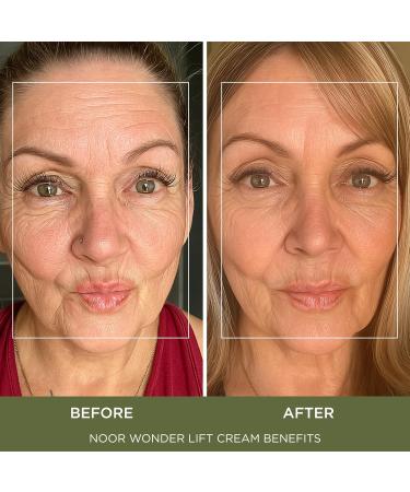 Noor Wonder Lift Cream for Women Natural Anti-Aging Wrinkle teatment with Syn-Ake natural blend Promotes Anti Aging and Significantly Less Wrinkles In As Little As A Few Days - Buy Online on GoSupps.com