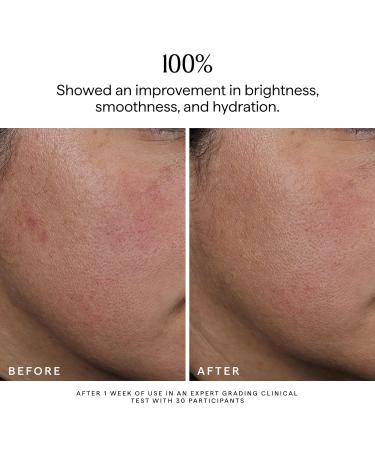 HERBIVORE Nova Facial Oil - Bi-Phase Oil with Tumeric + Niacinamide Serum and Oil in one Plant-based Vegan Cruelty-free 50 mL / 1.7 oz - Buy Online on GoSupps.com