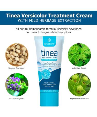 Roycederm Antifungal Cream for Tinea Versicolor & Athlete's Foot Treatment 2 oz - Fast Healing Anti Fungal Skin Cream - Buy Online on GoSupps.com