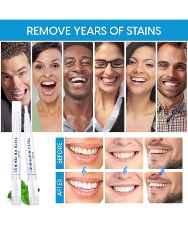 Teeth Whitening Pen Set - 3 Packs | Effective, Painless, Travel-Friendly, 35% Carbamide Peroxide | Natural Mint, No Sensitivity for Sensitive Teeth - Buy Online on GoSupps.com