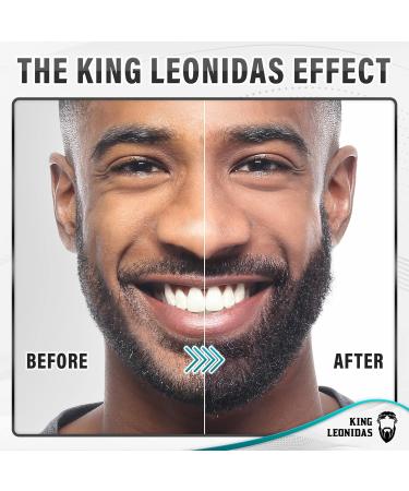 King Leonidas Beard Derma Roller 0.30mm Titanium Micro-Needling for Men - Facial Hair & Beard Growth - Buy Online on GoSupps.com